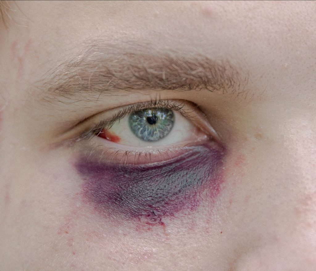 The Scars de Jędrzej Nowicki