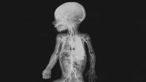 De humani corporis fabrica